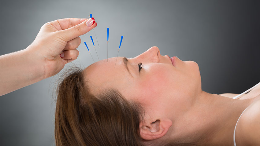 Mesa Acupuncture